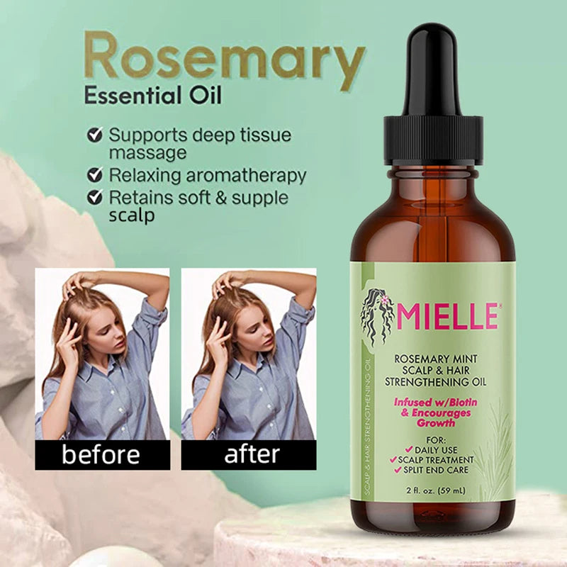 Rosemary Hair & Scalp OilRosemary Hair & Scalp Oil
