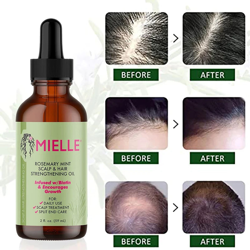 Rosemary Hair &amp; Scalp OilRosemary Hair &amp; Scalp Oil