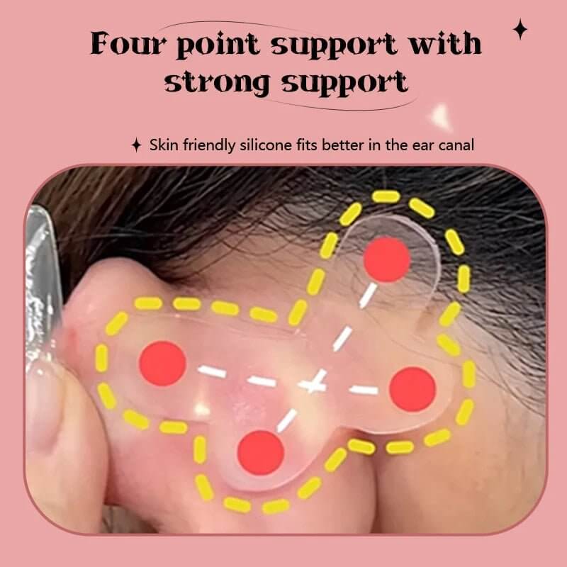 Silicone Ear Corrector Stickers |  Ear Fold Correction Tool