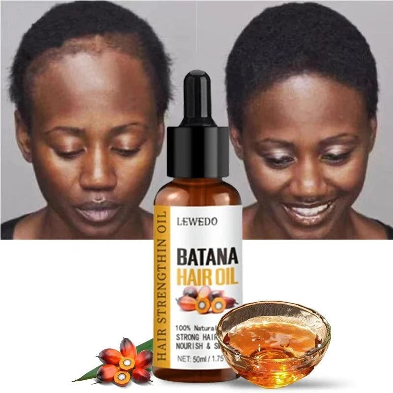 Lewedo Naturals Batana Oil Fast Hair Growth Oil for Men Women